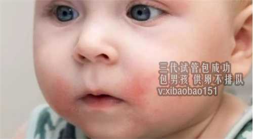 浙江哪有供卵机构，影响广州第三代试管婴儿价格的因素有哪些？